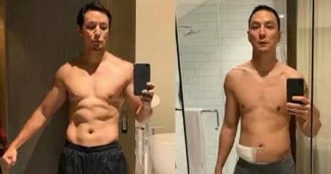 陈乔恩确诊盲肠炎 吴彦祖也曾自曝因阑尾炎暴瘦